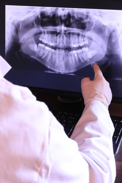 Best Emergency Dental Care for Broken or Chipped Teeth in Georgiana, AL