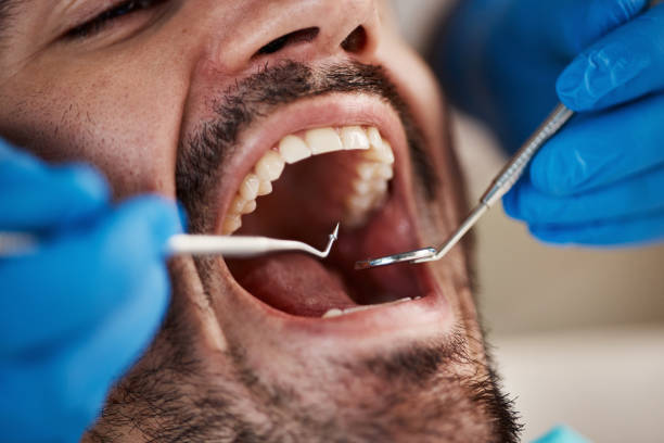 Best Same-Day Emergency Dental Services in Georgiana, AL