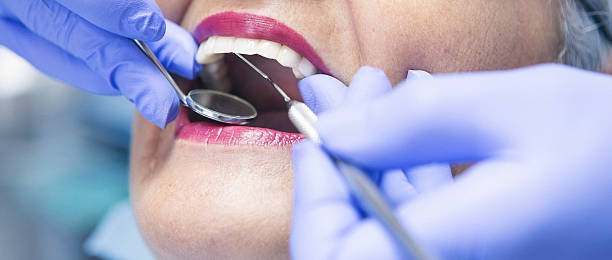 Best Emergency Tooth Extraction in Georgiana, AL