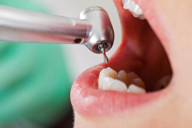 Best After-Hours Dental Trauma Care in Georgiana, AL